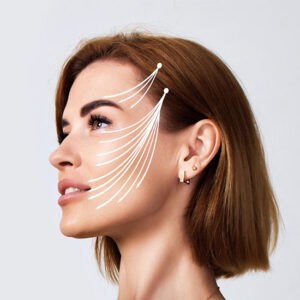 Lifting facial con hilos tensores